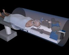 robot chirurgiczny neuroarm